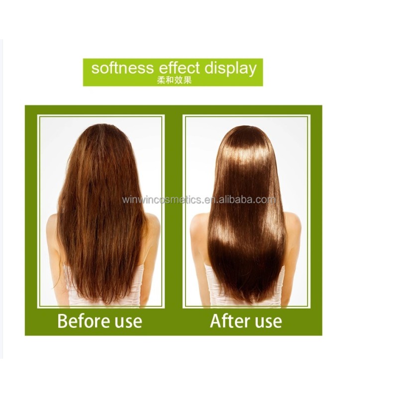 Biotin Shampoo Manufacturer - 5 in 1 Multifunction Hair Loss