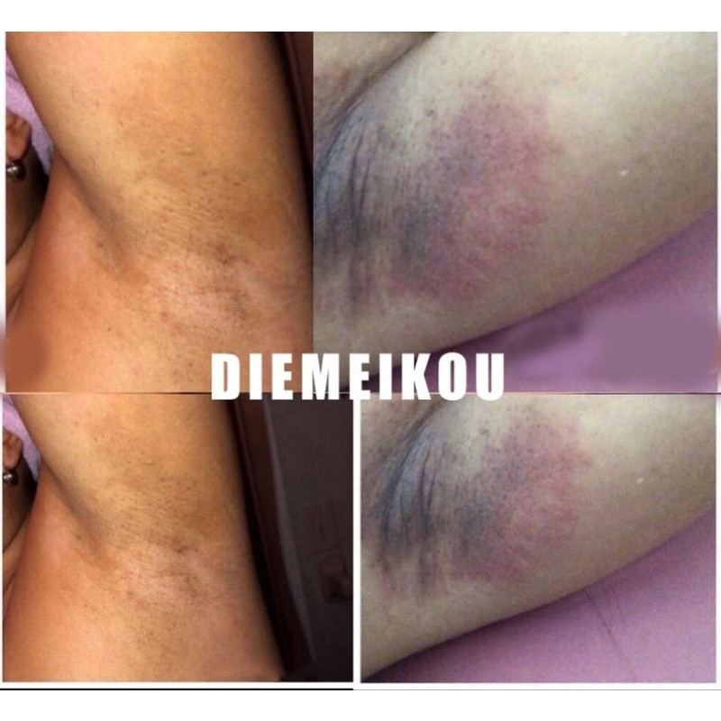 Skin Lightening Manufacturer - OEM Papaya Knuckle Whitening Korea