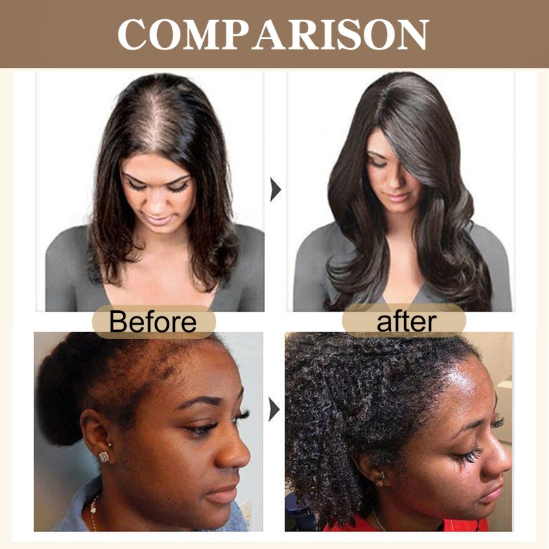 Batana Oil Manufacturer - Private Label Hair Growth Repair