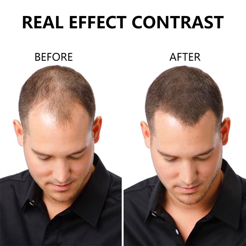 Hair Growth Shampoo Factory - Organic Flower Anti Hair Loss