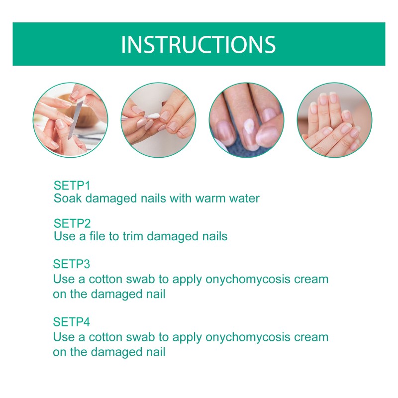 Nails Fungus Cream Manufacturer - Fungal Foot Toe Nails Gel Care