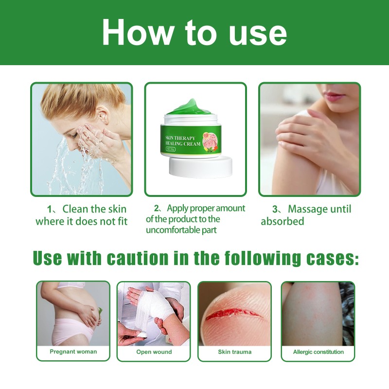 Skin Repair Cream Factory - Wholesale 30g Herbal Organic Anti Itch