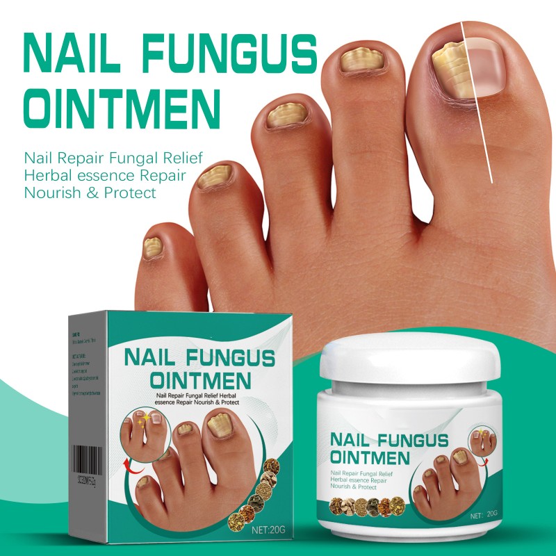 Nails Fungus Cream Manufacturer - Fungal Foot Toe Nails Gel Care