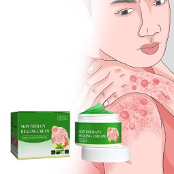 Skin Repair Cream Factory - Wholesale 30g Herbal Organic Anti Itch