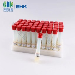 Collecting and Transportation Swab BPW Sampling Swabs with Buffered Peptone Water for Microbial Sampling