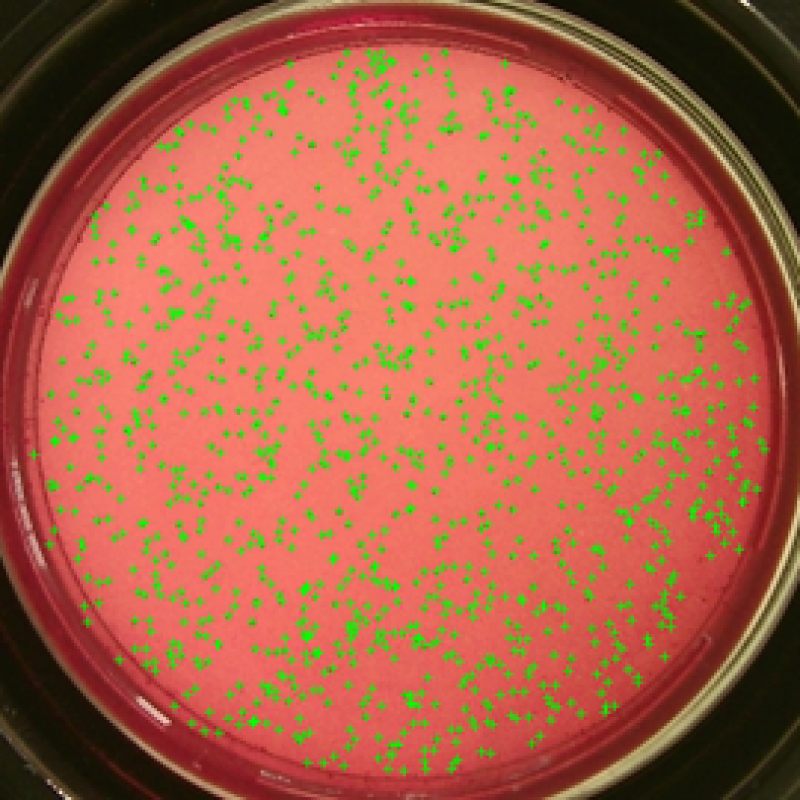 Automatic Colony Counter for Microorganism Counting, Lab Equipment