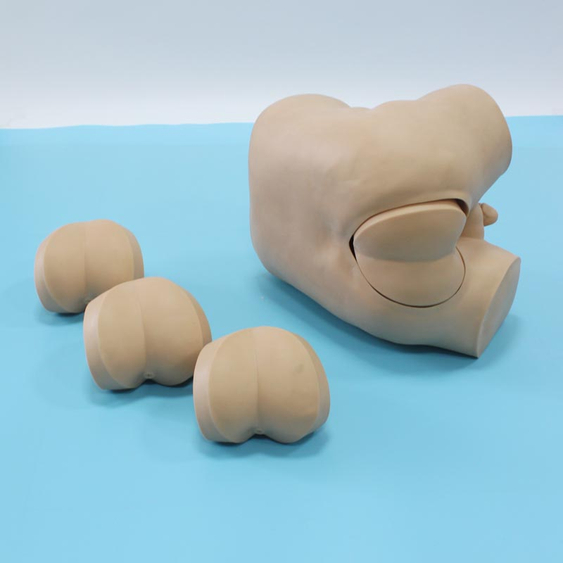 ICU Ventilator Manufacturer - Turbine Driven Respiratory Therapy