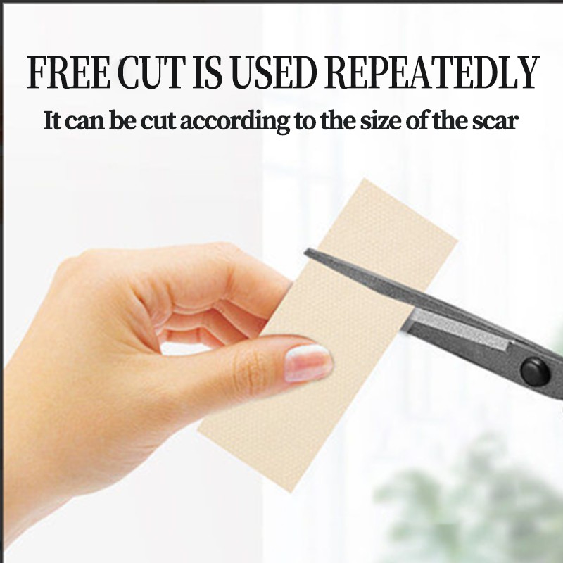 Scar Repair Sheet Manufacturer - 2025 Best Selling