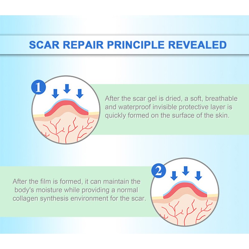 Silicone Scar Gel Manufacturer - Medical Waterproof Skin