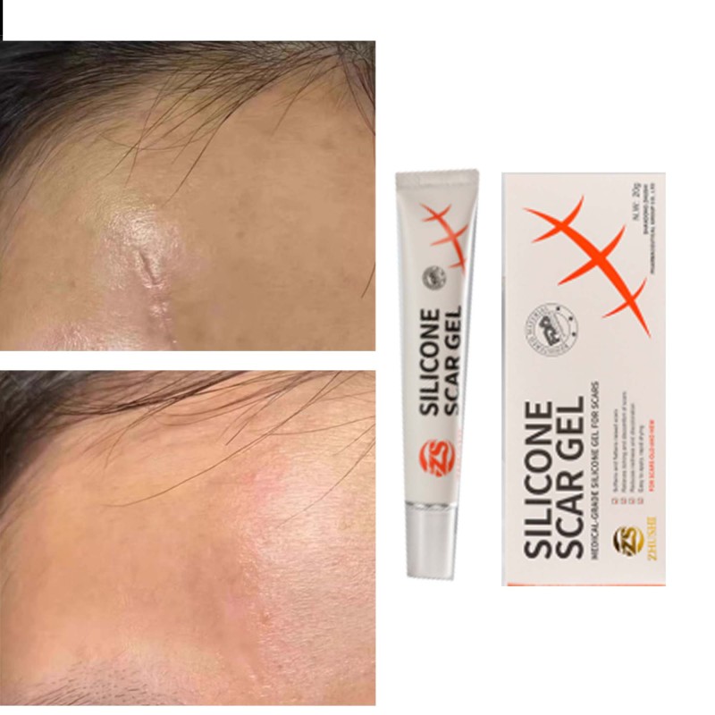 Silicone Scar Gel Manufacturer - Keloid Acne Repair