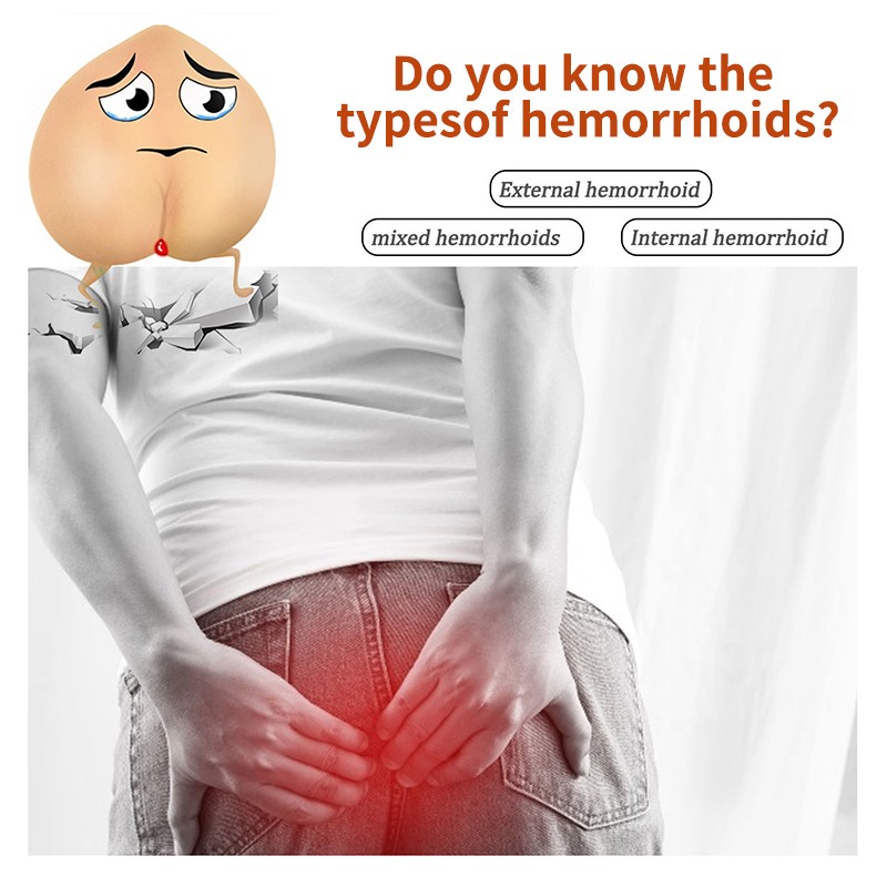 Hemorrhoids Ointment Factory - Best Premium Quality Anus Cleansing