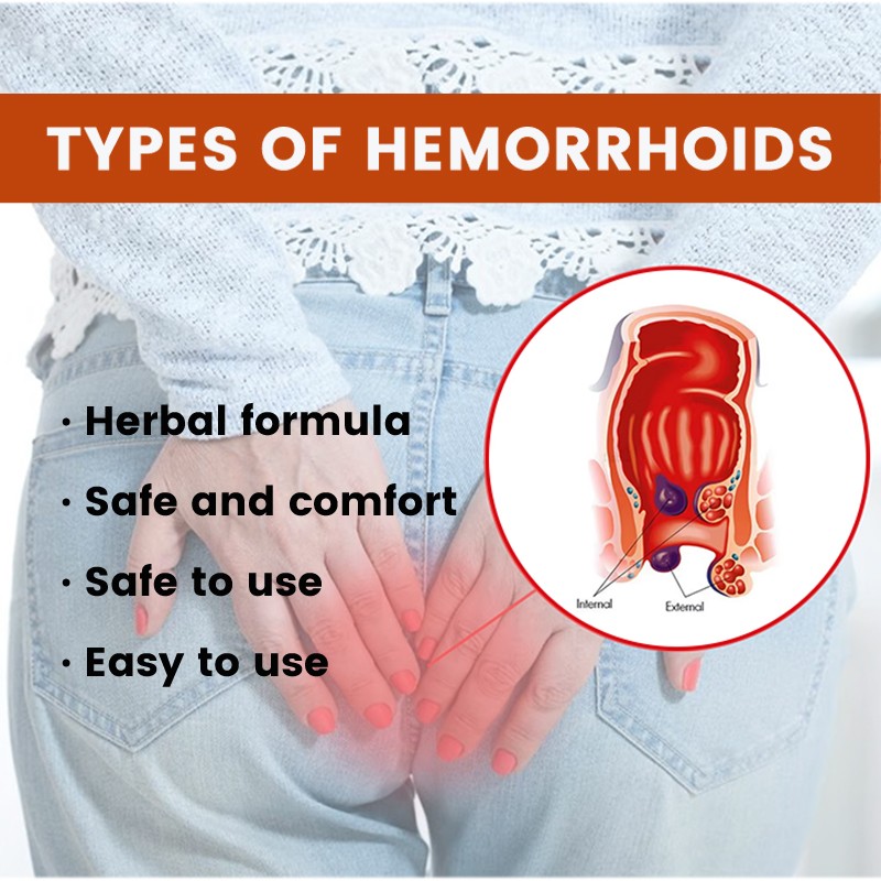 Hemorrhoids Ointment Factory - Best Premium Quality Anus Cleansing