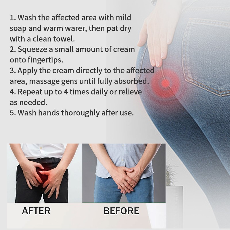 Anti-Hemorrhoids Ointment Manufacturer - Hot Supplier Body Back Relief