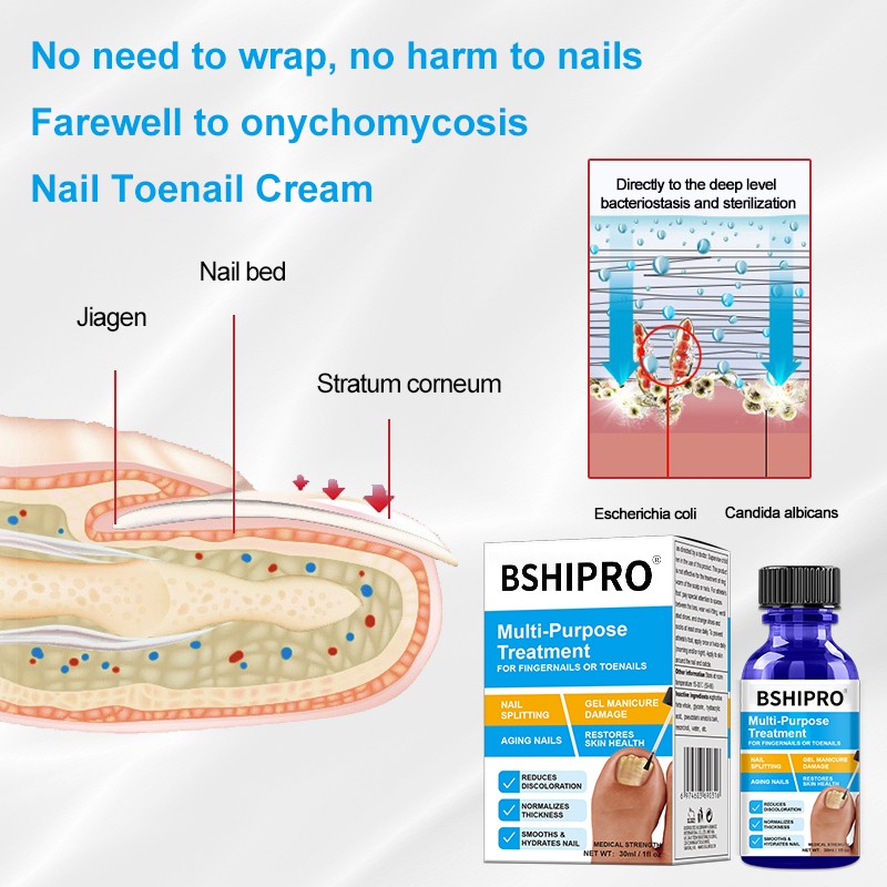 Nail Repair Kit Factory - OEM/ODM Toenail Fungus Treatment Brush