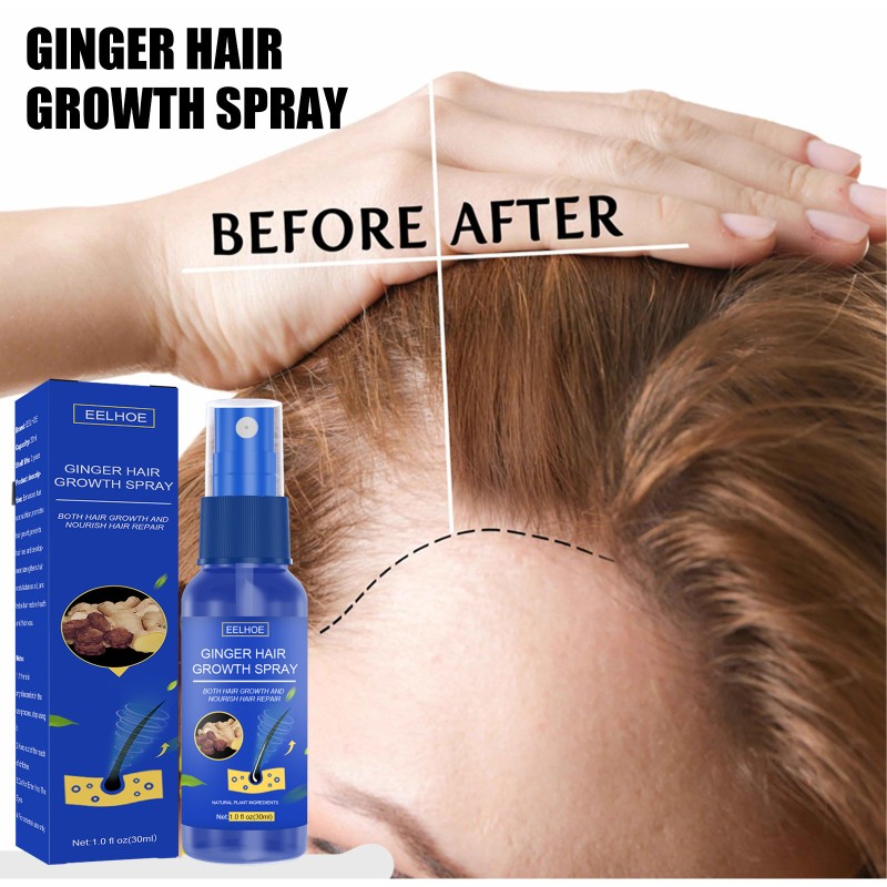 Herbal Spray Supplier - Essential Oil Ginger Regrowth