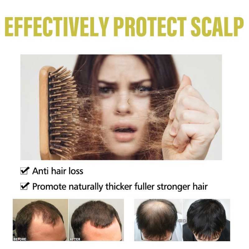 Herbal Shampoo Supplier - Black Ganoderma Ginger Anti Dandruff