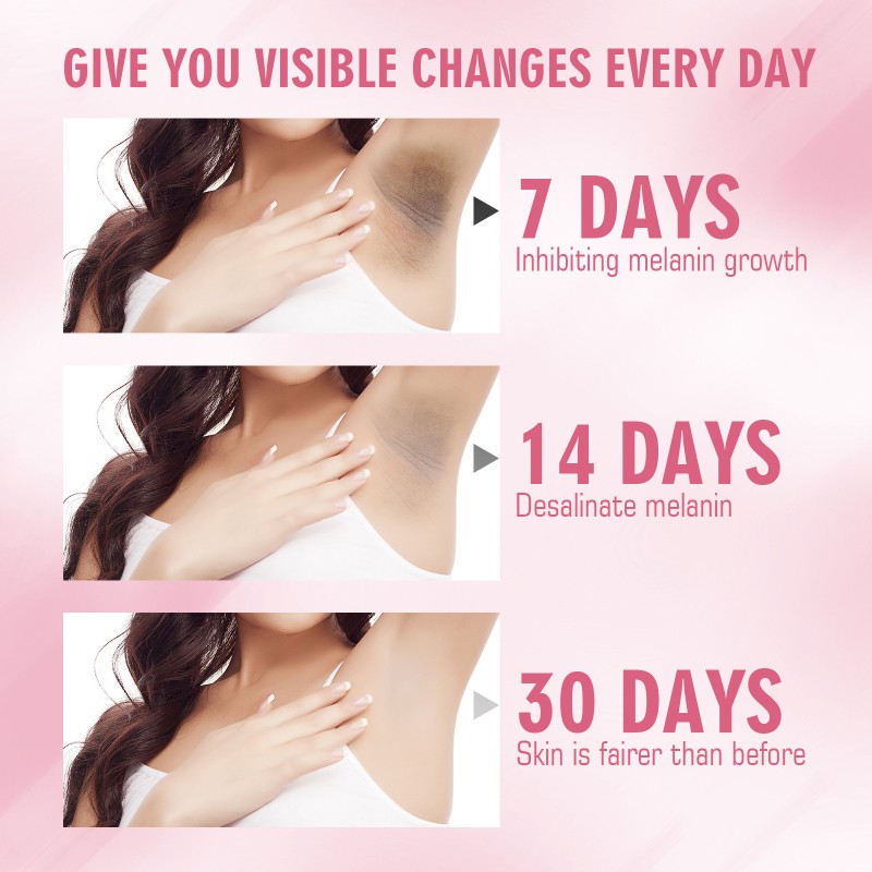 Body Whitening Cream Factory - Repairs Dull Underarms Brightens