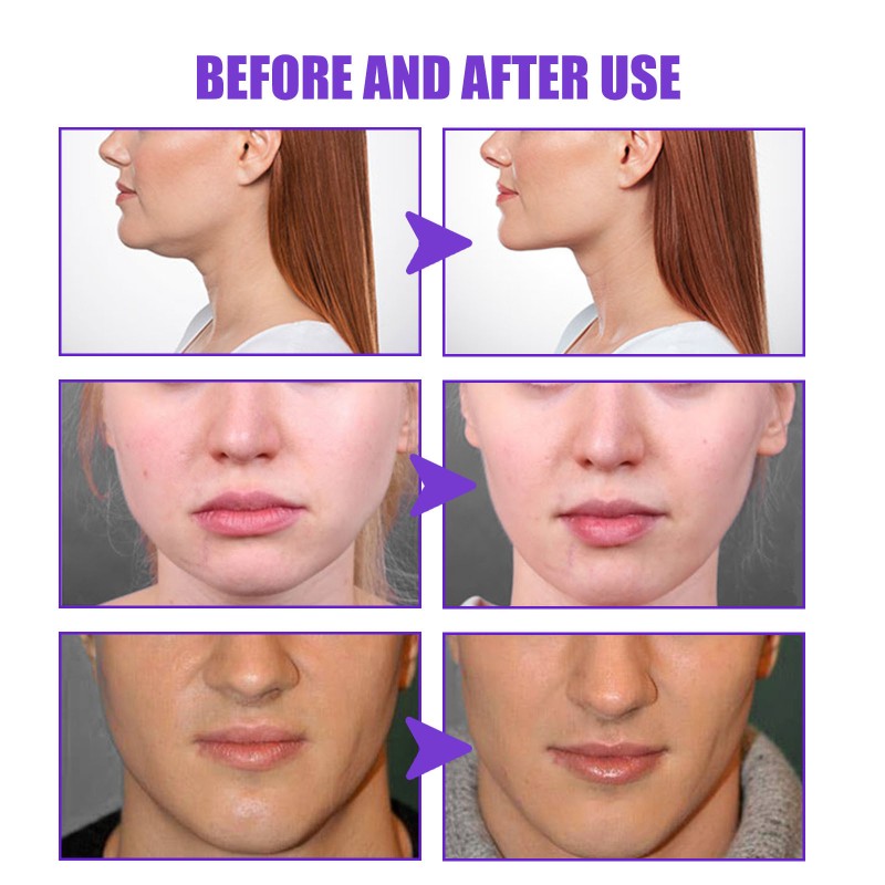 V Face Cream Supplier - Firming Contour Lift Jaw