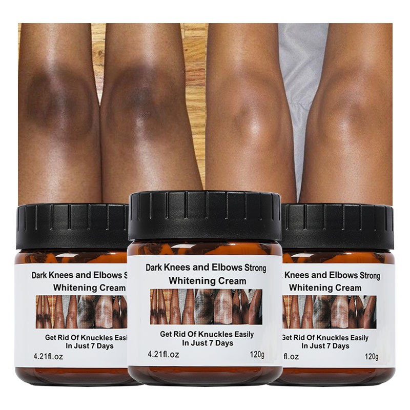 Niacinamide Cream Factory - Dark Knees Knuckles Elbows Whitening