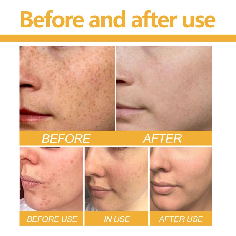 Turmeric Soap Manufacturer - Deep Cleaning Whitening Rejuvenation