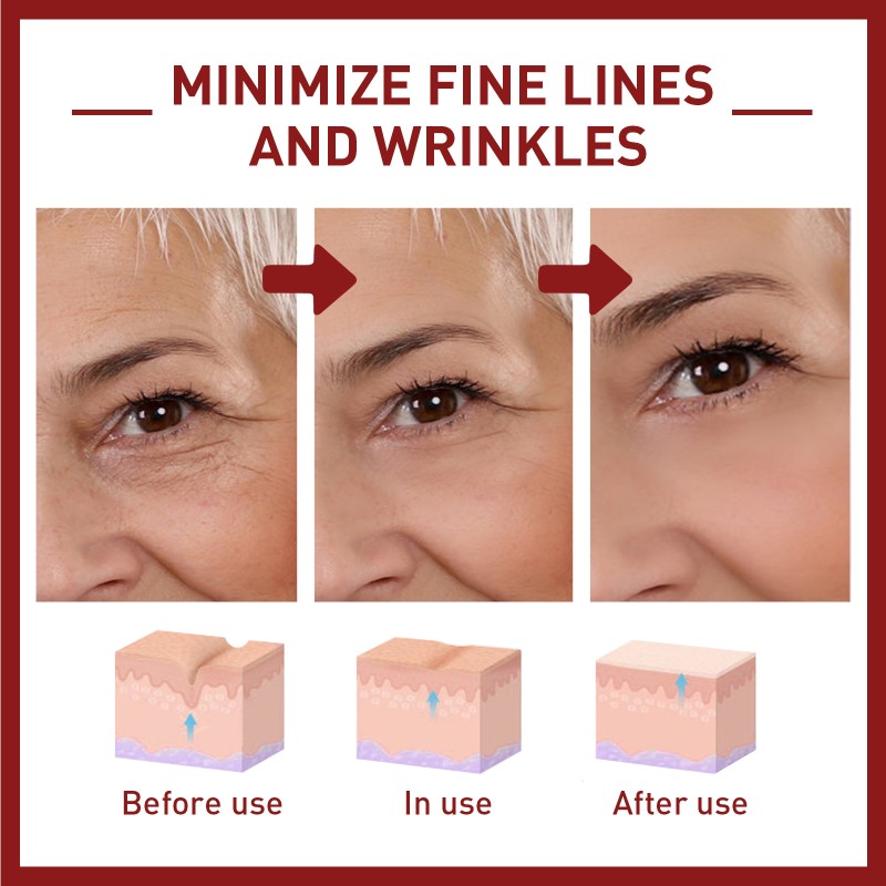 Facial Plump Oil Factory - Fengying Temple Fine Lines Fruit