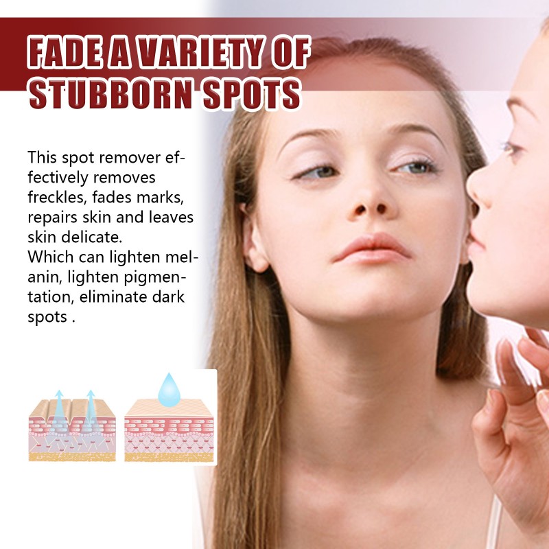 Blemish Cream Factory - Hot Sale Fade Freckles Whitening