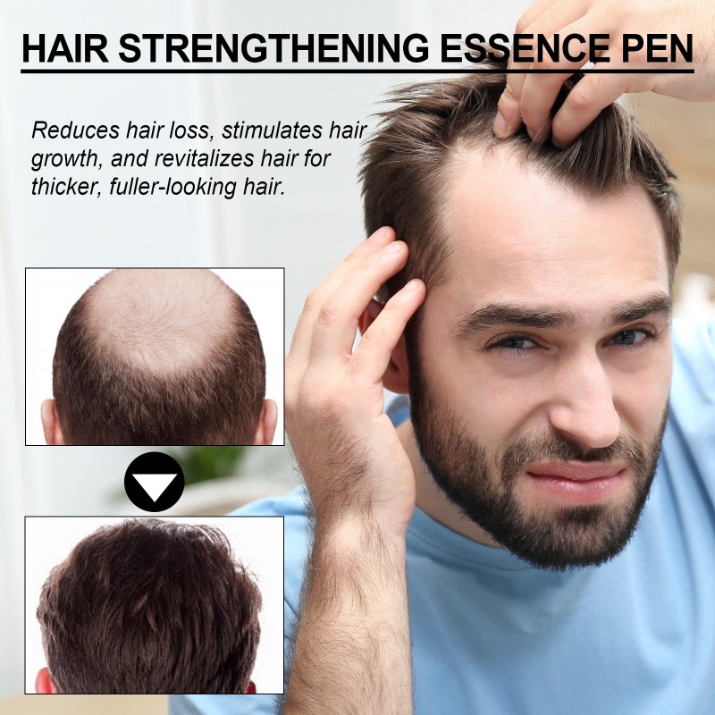 Hair Essence Manufacturer - Scalp Massage Soft Dense Serum