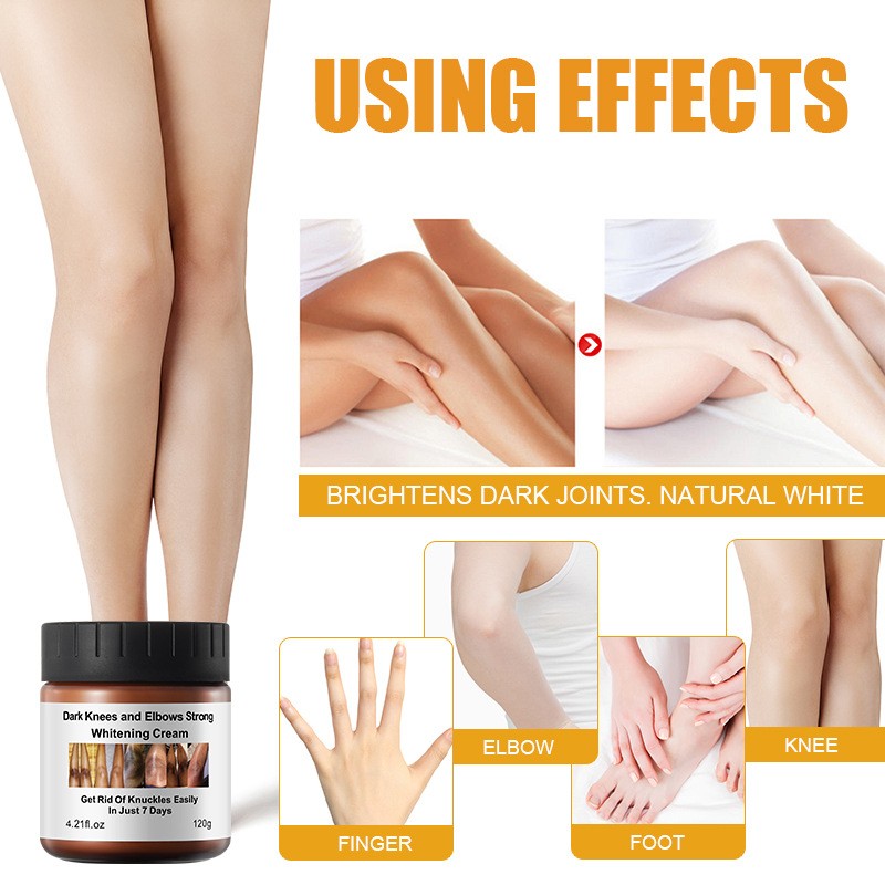 Niacinamide Cream Factory - Dark Knees Knuckles Elbows Whitening