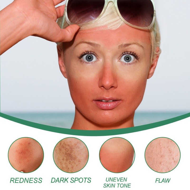 Color Correcting Cream Manufacturer - Natural Organic Salicylic Acid