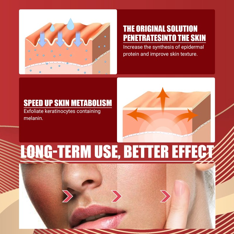 Cherry Essence Factory - Needle Leaf Brighten Dark Skin