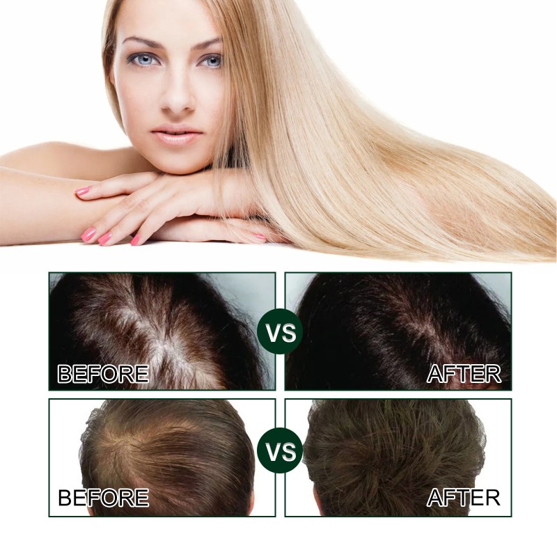 Organic Hair Serum Factory - Eelhoe Wild Oil Boosting Bald