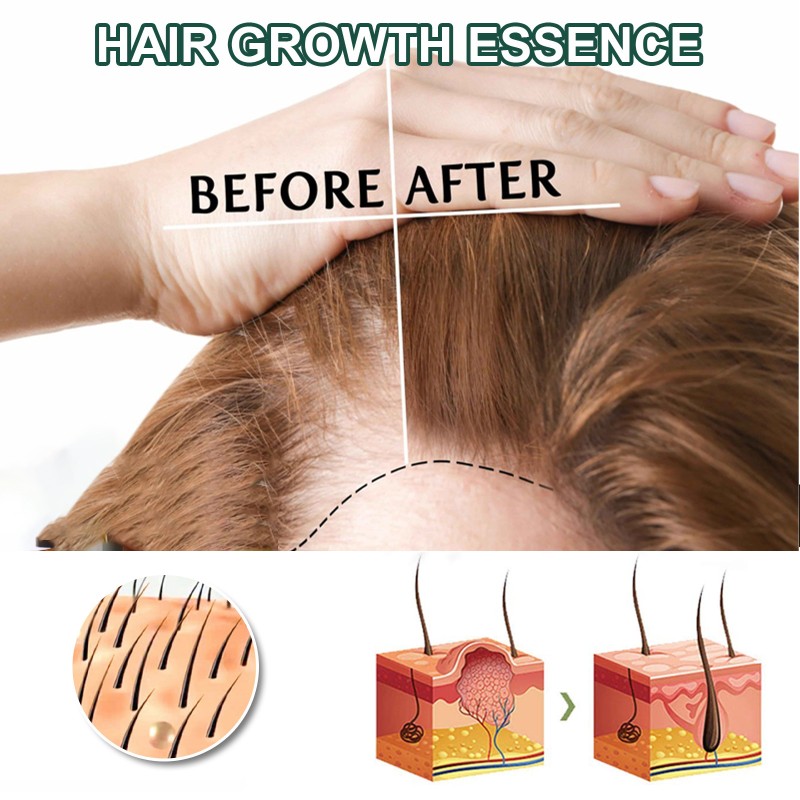 Hair Growth Serum Supplier - 7 Days Anti Loss Repair Care