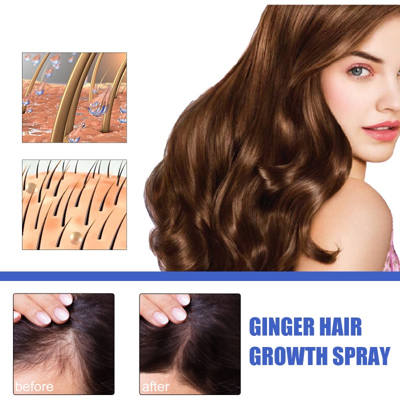 Herbal Spray Supplier - Essential Oil Ginger Regrowth