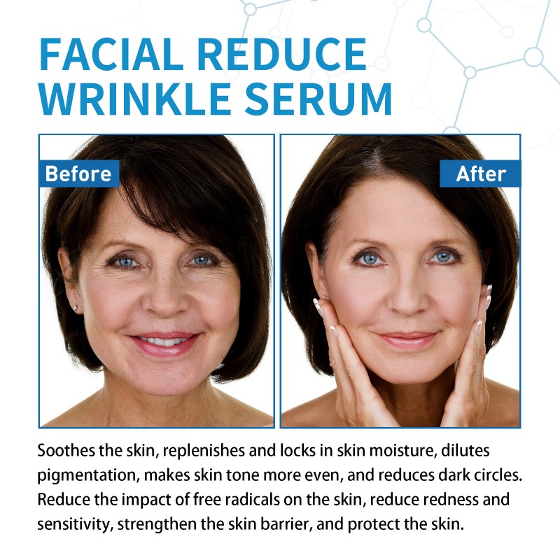 HYALU B5 Serum Factory - Anti Aging Wrinkle Reducing