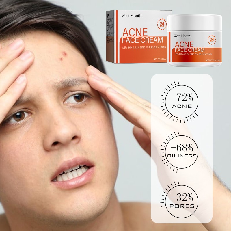 Acne Removal Cream Supplier - Herbal Oil Control BHA Salicylic