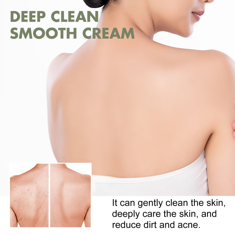 Deep Cleansing Cream Manufacturer - South Moon Rejuvenation Acne