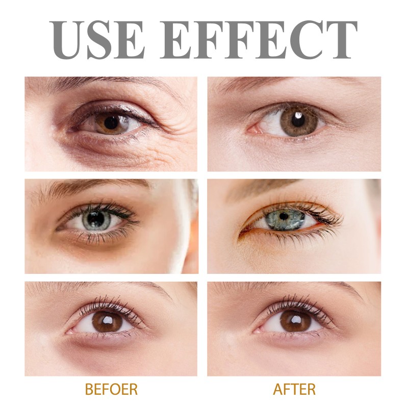 Eye Firming Gel Factory - OEM ODM Smoothing Anti-Puffiness