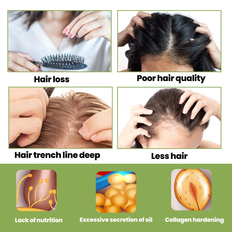 Hair Growth Oil Factory - 100% Natural Herbal Organic