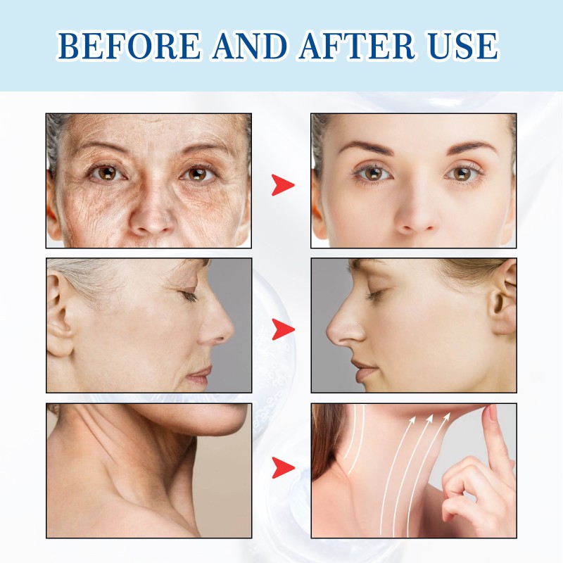 Hyaluronic Acid Liquid Manufacturer - Moisturizing Anti-wrinkle Repair