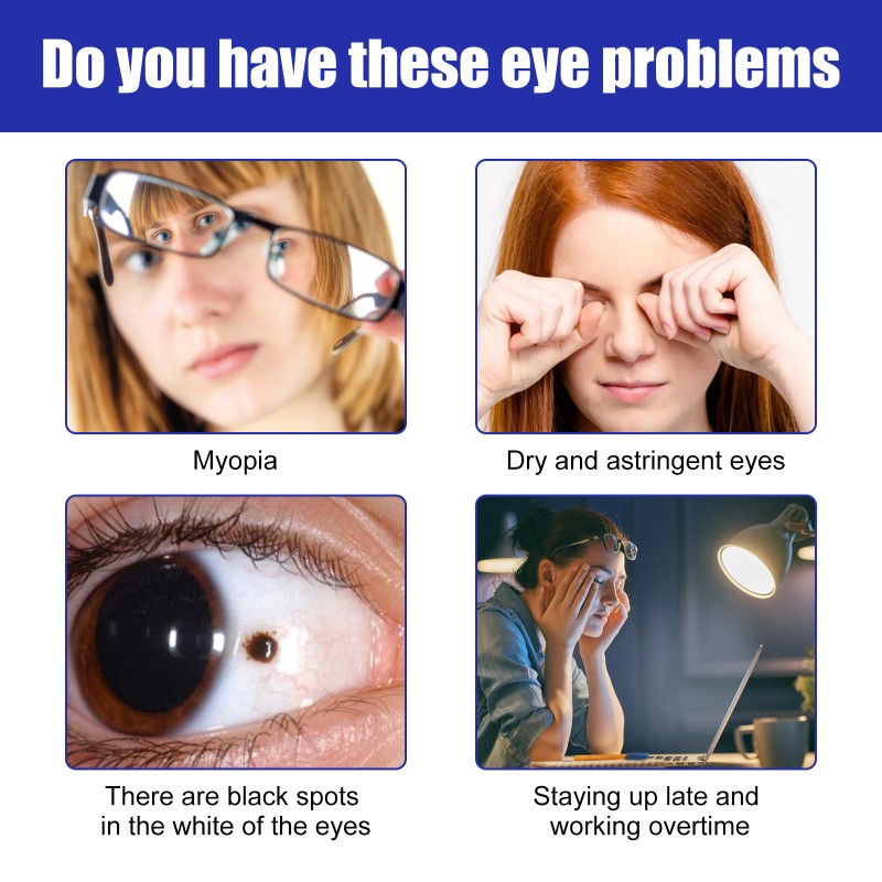 Under Eye Cream Supplier - Instantly Reduces Bags Removal