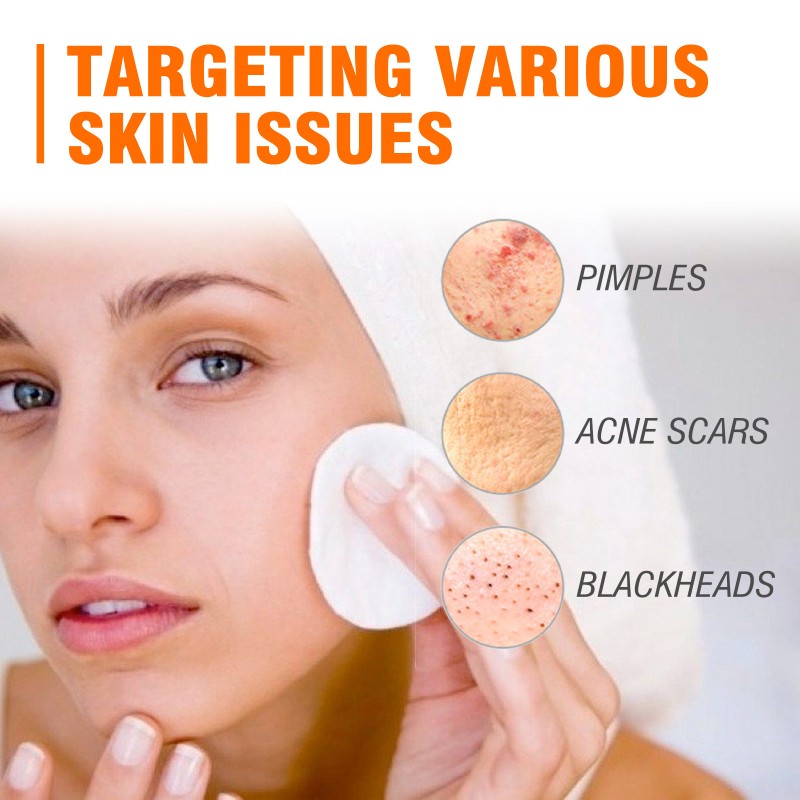 Acne Removal Cream Supplier - Herbal Oil Control BHA Salicylic