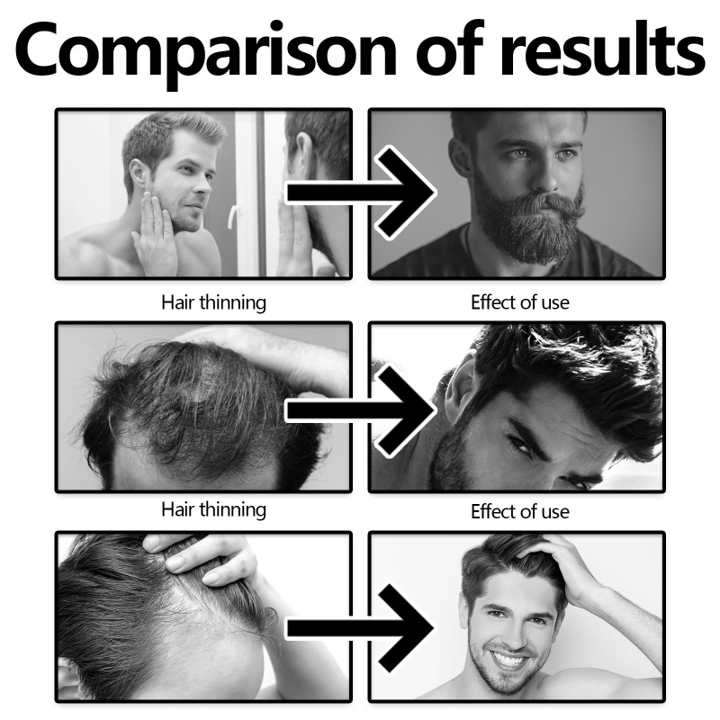 Hair Root Spray Factory - Anti Loss Strong Anti-Drying Care