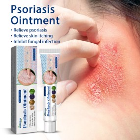 Psoriasis Ointment Supplier - 20g Acne Dermatitis Eczema