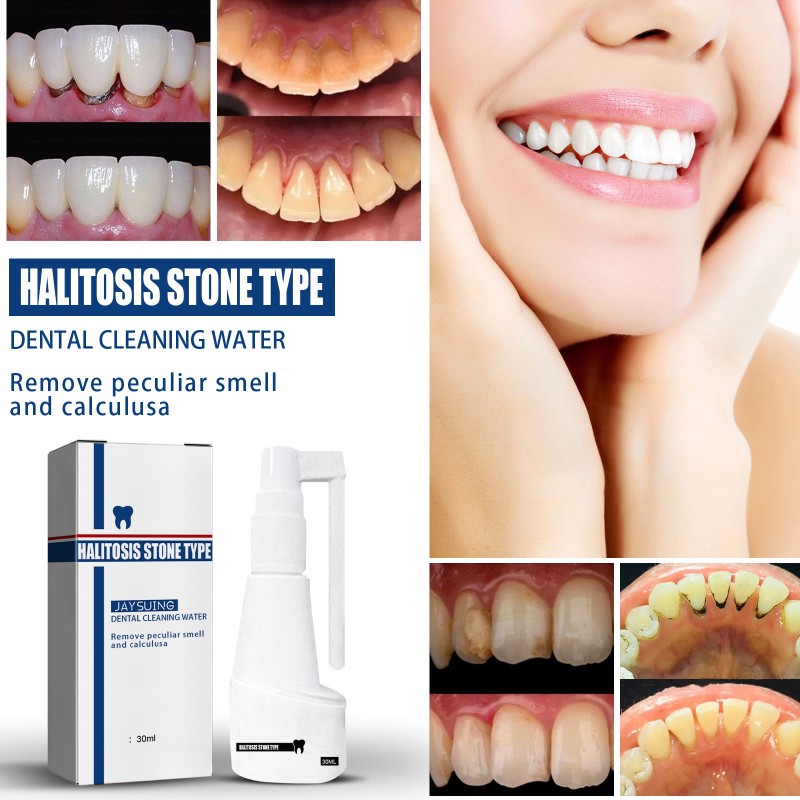 Oral Spray Manufacturer - Jaysuing Calculus Dissolving Deodorant