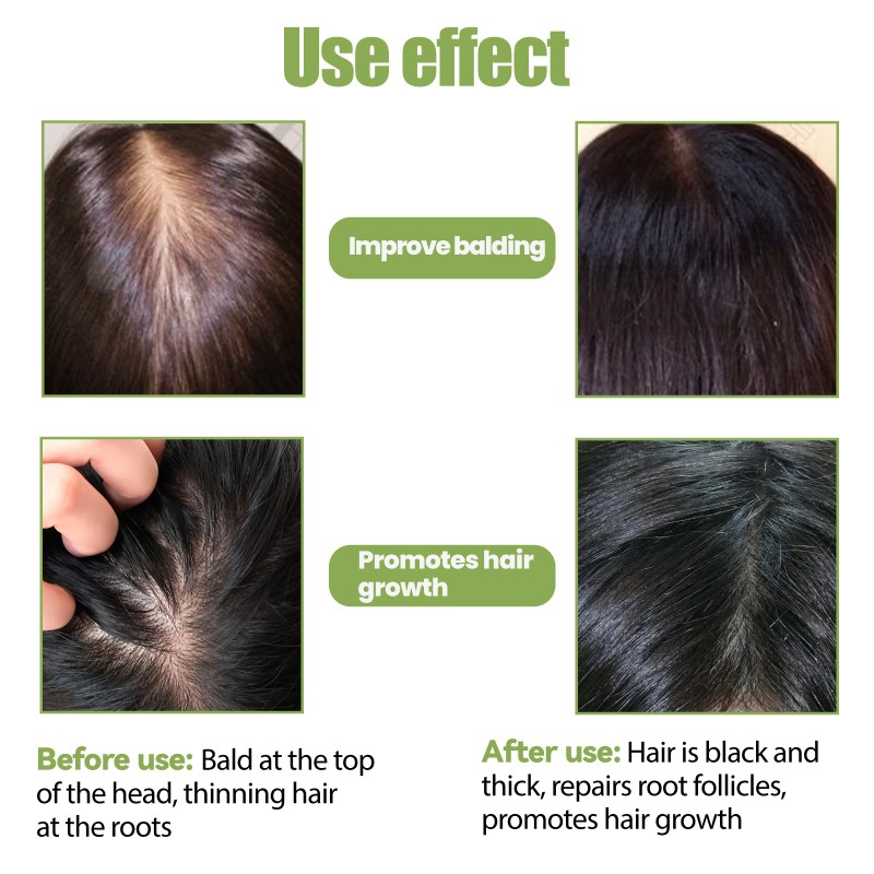 Hair Growth Oil Factory - 100% Natural Herbal Organic