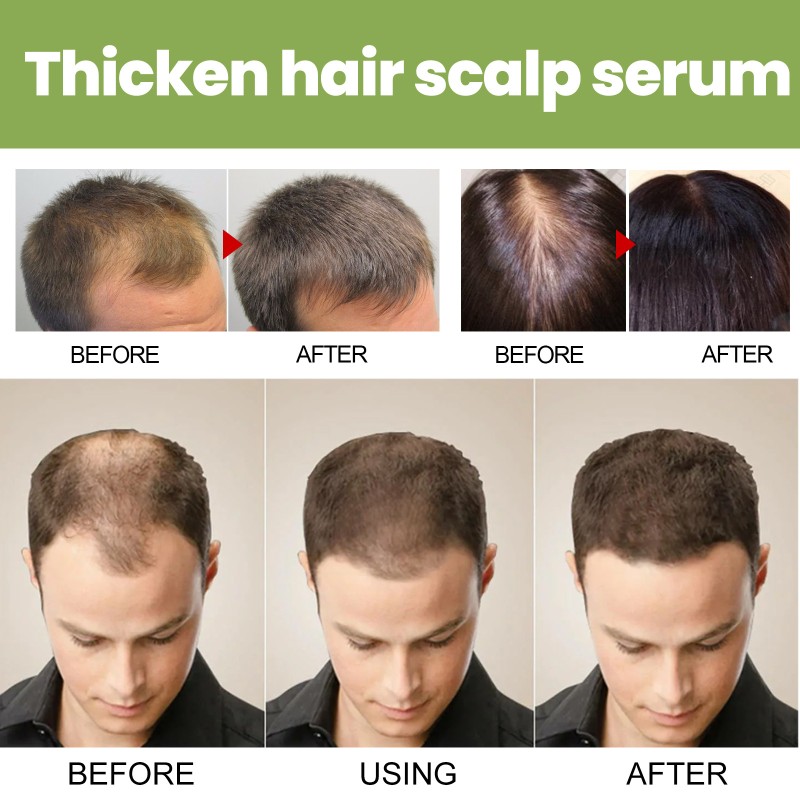 Hair Growth Oil Factory - 100% Natural Herbal Organic