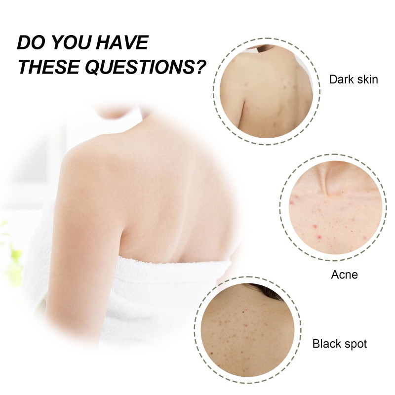 Deep Cleansing Cream Manufacturer - South Moon Rejuvenation Acne