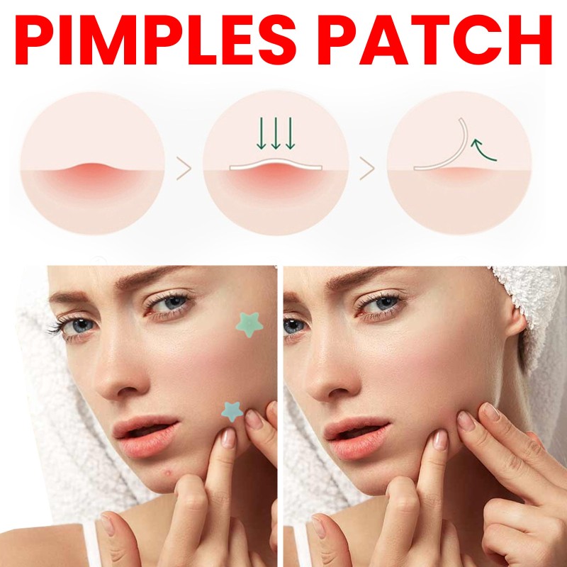Pimple Patches Factory - Fast Acting Pus Absorption Swelling