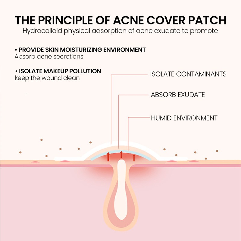 Pimple Patches Factory - Fast Acting Pus Absorption Swelling