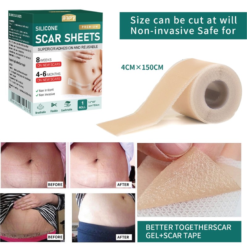 Scar Healing Patches Supplier - Moist Environment Faster Healing